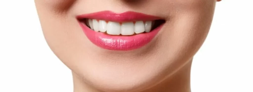 لبخند زیبا بعد از ایمپلنت دندان