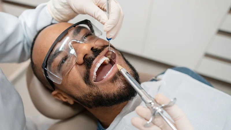 مراحل انجام کامپوزیت دندان
