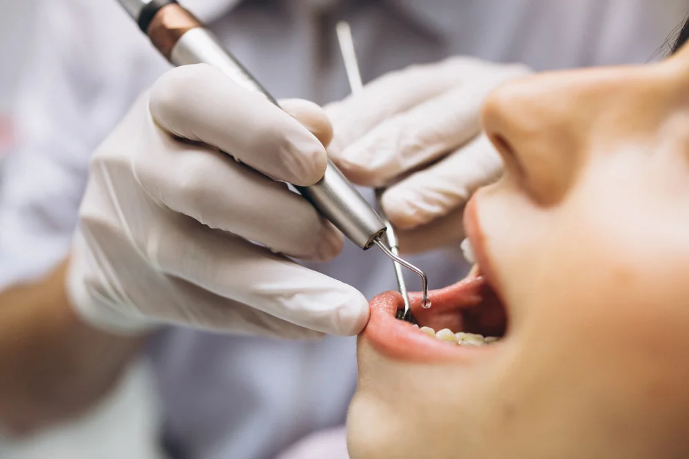 چه زمانی نیاز به جراحی دندان عقل است؟