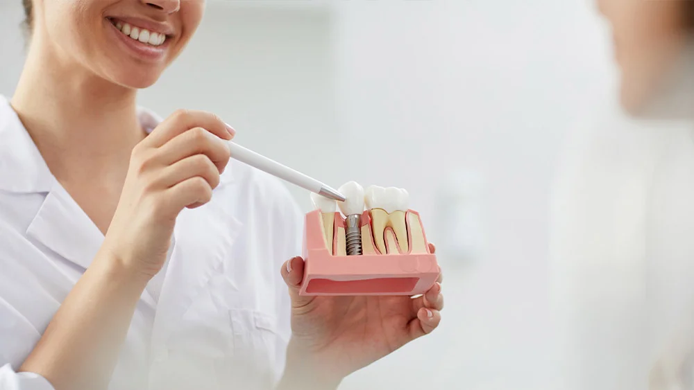 انواع راه های کاشت دندان